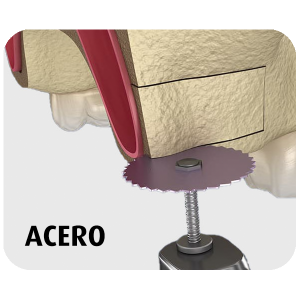 Acero
