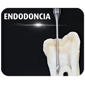 Endodoncia