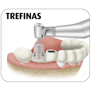 Trefinas