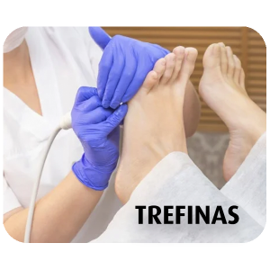 Trefinas